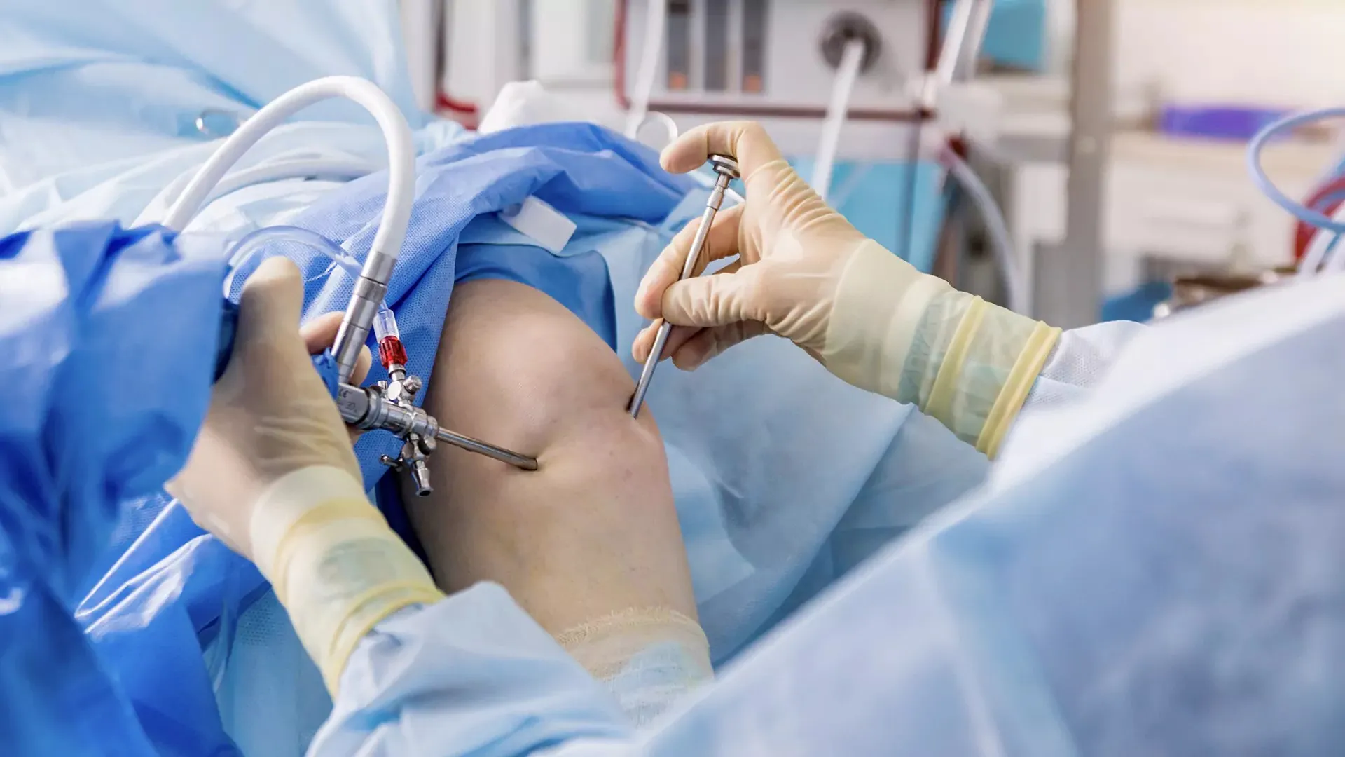 Arthroscopy