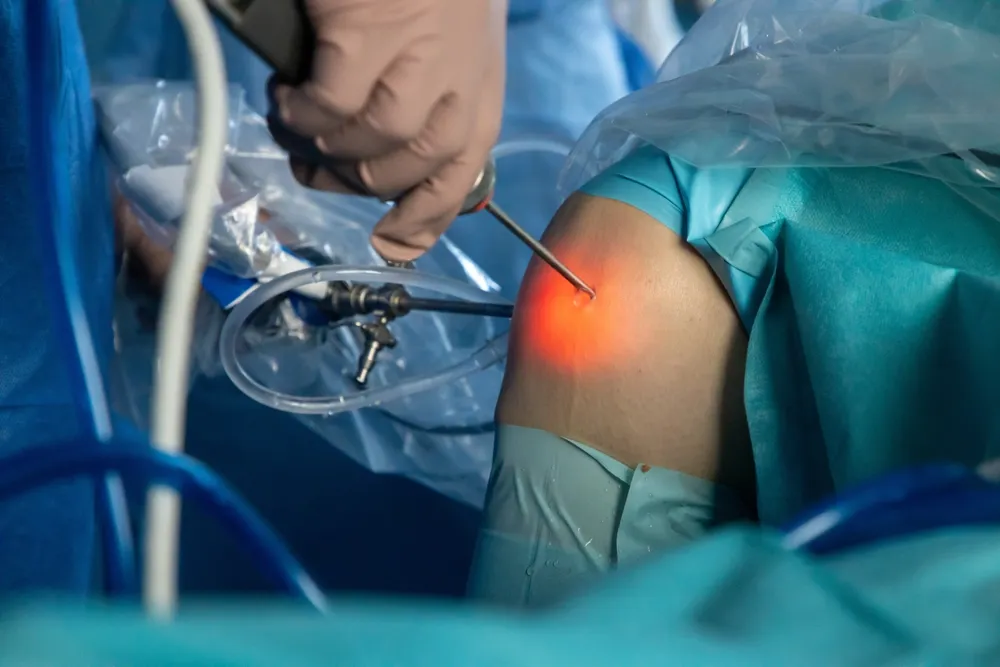 Knee Arthroscopy